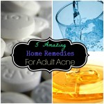 5 Amazing Natural Remedies for Adult Acne